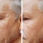 Top-Rated Facial Plastic Surgeon Montgomery County PA - Facelift Surgical - Goldberg Facial Plastic Surgery - Transform your appearance with facelift surgical procedures. Explore the process, benefits, and remarkable results in our comprehensive guide. -  -  Goldberg Facial Plastic Surgery