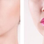 Top-Rated Facial Plastic Surgeon Montgomery County PA - Lip Augmentation - Are you unhappy with the shape or size of your nose? Do you desire facial harmony that will enhance your overall appearance? -  -  Goldberg Facial Plastic Surgery