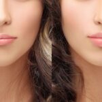 Top-Rated Facial Plastic Surgeon Montgomery County PA - Lip Augmentation - Are you unhappy with the shape or size of your nose? Do you desire facial harmony that will enhance your overall appearance? -  -  Goldberg Facial Plastic Surgery