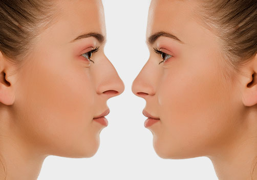 Top-Rated Facial Plastic Surgeon Montgomery County PA - Rhinoplasty (Nose Job) - Dr. Josh Goldberg is known for the best nose job (Rhinoplasty) in Montgomery County, PA. Dr. Goldberg can transform your nose into the way you always wanted it. -  - Top-Rated Facial Plastic Surgeon Montgomery County PA - Rhinoplasty (Nose Job) - Dr. Josh Goldberg is known for the best nose job (Rhinoplasty) in Montgomery County, PA. Dr. Goldberg can transform your nose into the way you always wanted it. -  - proportionate-nostrils Goldberg Facial Plastic Surgery Goldberg Facial Plastic Surgery