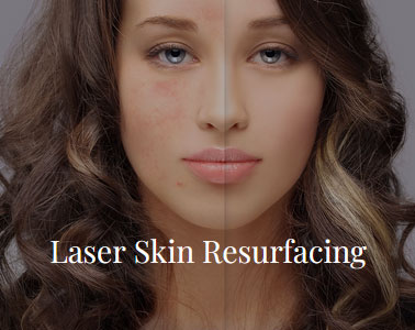 laser skin