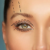 Top-Rated Facial Plastic Surgeon Montgomery County PA - Corrective Surgery for Facial Injuries - If you are unhappy with the way you look due to an accident or injury, corrective facial plastic surgery may be right for you. -  - Top-Rated Facial Plastic Surgeon Montgomery County PA - Corrective Surgery for Facial Injuries - If you are unhappy with the way you look due to an accident or injury, corrective facial plastic surgery may be right for you. -  - Blepharoplasty Goldberg Facial Plastic Surgery Goldberg Facial Plastic Surgery