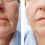 Top-Rated Facial Plastic Surgeon Montgomery County PA - Facelift Surgical -  -  -  Goldberg Facial Plastic Surgery