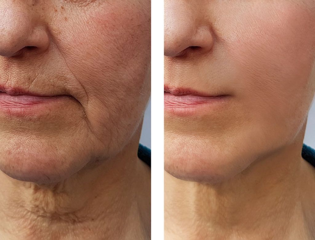 Top-Rated Facial Plastic Surgeon Montgomery County PA - Achieving Ageless Beauty: Dr. Goldberg's Expertise in Facial Plastic Surgery -  -  - rhinoplasty Goldberg Facial Plastic Surgery
