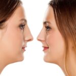 Top-Rated Facial Plastic Surgeon Montgomery County PA - Rhinoplasty (Nose Jobs) - Goldberg Facial Plastic Surgery - Rhinoplasty (Nose Jobs), Get the Nose You’ve Always Wanted.- Explore benefits, and stunning transformations. Click now to uncover how rhinoplasty can harmoniz -  -  Goldberg Facial Plastic Surgery