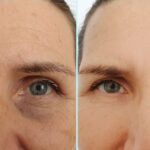 Top-Rated Facial Plastic Surgeon Montgomery County PA - Injectables -  -  -  Goldberg Facial Plastic Surgery