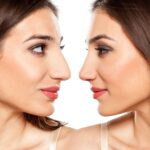 Top-Rated Facial Plastic Surgeon Montgomery County PA - Rhinoplasty (Nose Jobs) -  -  -  Goldberg Facial Plastic Surgery