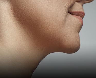 Top-Rated Facial Plastic Surgeon Montgomery County PA - FACIAL NON SURGICAL -  -  - Top-Rated Facial Plastic Surgeon Montgomery County PA - FACIAL NON SURGICAL -  -  - neck-lift Goldberg Facial Plastic Surgery Goldberg Facial Plastic Surgery